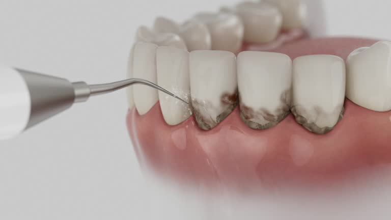 Trusted Teeth Cleaning And Checkup service in Waterville, WA - Dentist Open Now